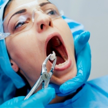 Dentist performing a tooth extraction on a patient