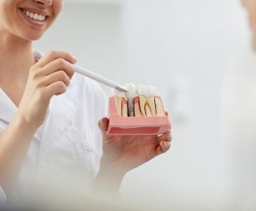 Dentist pointing to a model of a dental implant in the jaw