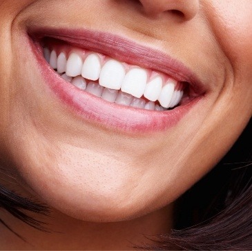 Close up of smile with straight white teeth