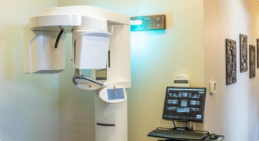 Advanced dental scanning technology