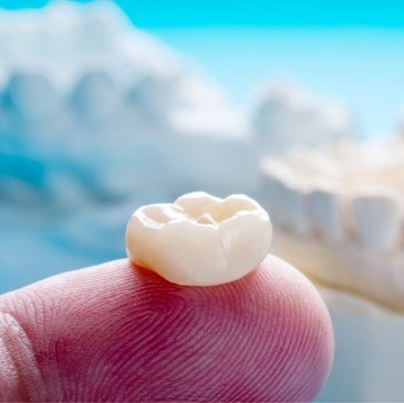 Person holding a dental crown on their finger