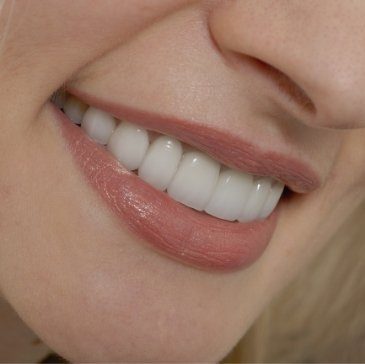 Close up of smile with straight white teeth