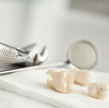 Several extracted teeth on gauze next to dental mirror and forceps