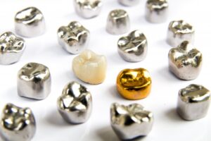 Metal dental crowns. 