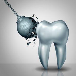 A wrecking ball cracking against a tooth.