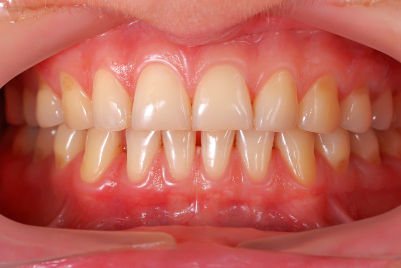 Premier Family Dental Blog