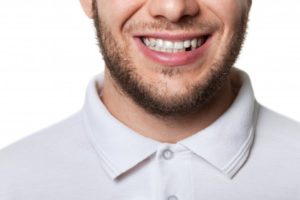 man missing tooth smile