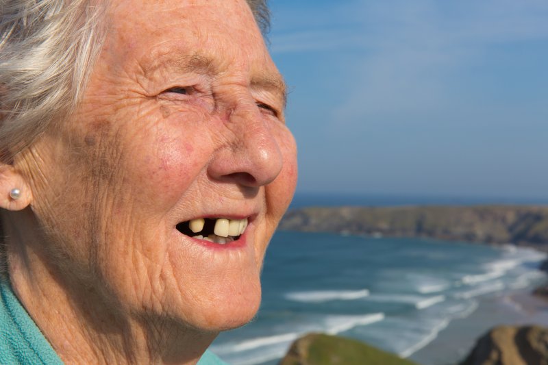 An older woman with tooth loss.