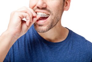 Why should I get ClearCorrect from my dentist in Waco, TX?