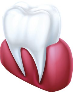 Your Waco dentist provides periodontal therapy. 