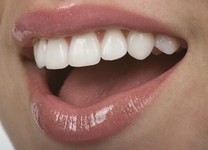 teeth whitening in waco